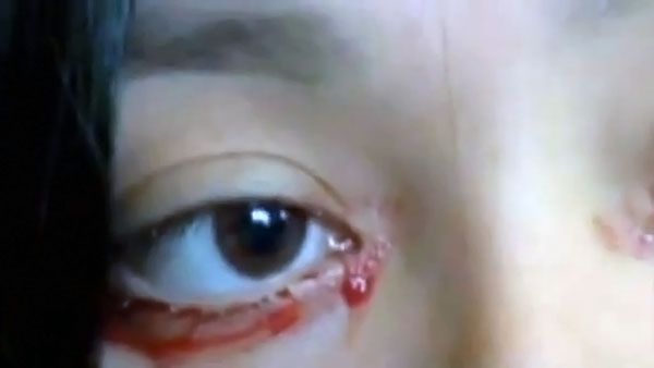 Il mistero della ragazza che piange lacrime di sangue